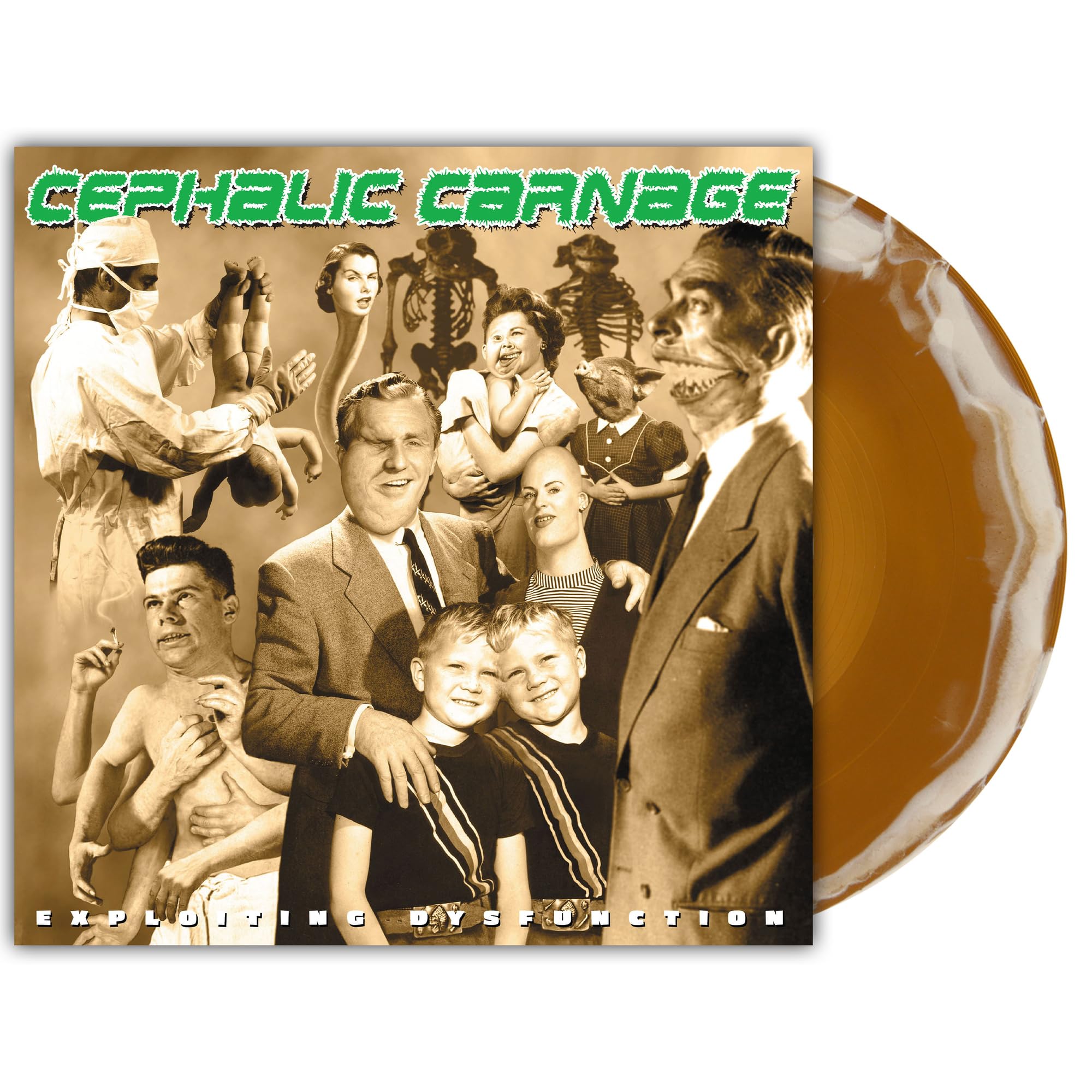 Exploiting Dysfunction Deluxe 25th Anniversary